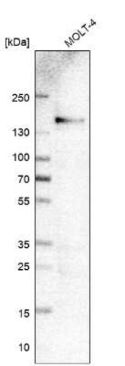 Integrin alpha 4/CD49d Antibody (CL11294), Novus Biologicals 25 &mu;g | Buy Online | Novus Biologicals | Fisher Scientific
