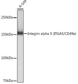 Integrin alpha 5/CD49e Rabbit anti-Human, Mouse, Rat, Clone: 8F2O6, Novus Biologicals 100 &mu;g | Buy Online | Bio-Techne | Fisher Scientific