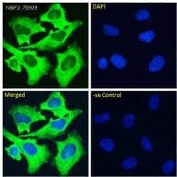 Integrin alpha 5 beta 1 Antibody (M200 (Volociximab)) - Azide and BSA Free,