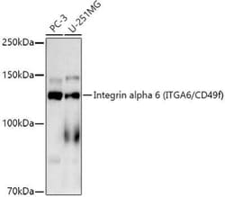 Integrin alpha 6/CD49f Rabbit anti-Human, Mouse, Rat, Clone: 2R5F1, Novus