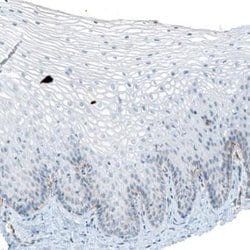 Integrin alpha 6/CD49f Antibody (CL6957), Novus Biologicals:Antibodies:Primary