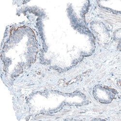 Integrin alpha 6/CD49f Antibody (CL6957), Novus Biologicals:Antibodies:Primary