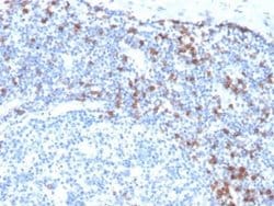 Integrin alpha E/CD103 Rabbit anti-Human, Clone: ITGAE/3904R, Novus Biologicals:Antibodies:Primary