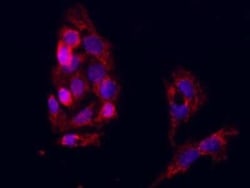Integrin alpha E/CD103 Antibody, Novus Biologicals 50 &mu;g, Unconjugated:Antibodies,