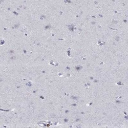 Integrin alpha E/CD103 Rabbit anti-Human, Polyclonal, Novus Biologicals:Antibodies:Primary