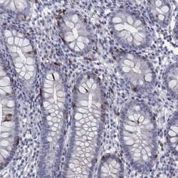 Integrin alpha E/CD103 Rabbit anti-Human, Polyclonal, Novus Biologicals:Antibodies:Primary