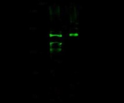 Integrin alpha E/CD103 Antibody, Novus Biologicals 50 &mu;g, Unconjugated:Antibodies,