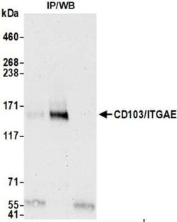 Integrin alpha E2/Dendritic Cells Antibody (BLR171J), Novus Biologicals 100 &mu;g | Buy Online | Novus Biologicals | Fisher Scientific