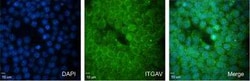 Integrin alpha V/CD51 Rabbit anti-Human, Mouse, Rat, Clone: 7O8N2, Novus