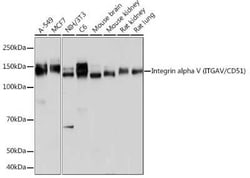 Integrin alpha V/CD51 Rabbit anti-Human, Mouse, Rat, Clone: 7O8N2, Novus