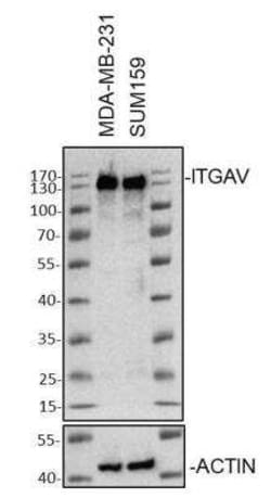 Integrin alpha V/CD51 Rabbit anti-Human, Mouse, Rat, Clone: 7O8N2, Novus