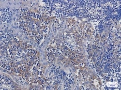 Integrin alpha V/CD51 Antibody (S03-6E3), Novus Biologicals:Antibodies:Primary