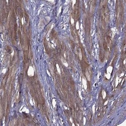 Integrin beta 1/CD29 Antibody, Novus Biologicals 100 &mu;g; Unconjugated:Antibodies,