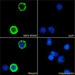 Integrin beta 2/CD18 Antibody (1B4) - Chimeric - Azide and BSA Free, Novus