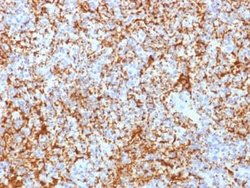 Integrin beta 3/CD61 Rabbit anti-Human, Clone: ITGB3/2166R, Novus Biologicals:Antibodies:Primary