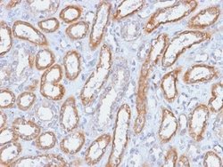 Integrin beta 3/CD61 Rabbit anti-Human, Clone: ITGB3/2166R, Novus Biologicals:Antibodies:Primary
