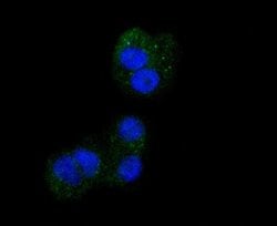 Integrin beta 3/CD61 Antibody (SJ19-09), Novus Biologicals 100&mu;L:Antibodies,