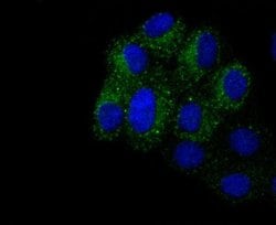 Integrin beta 3/CD61 Antibody (SJ19-09), Novus Biologicals 100&mu;L:Antibodies,
