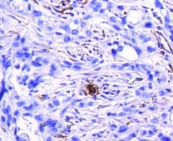 Integrin beta 3/CD61 Antibody (SJ19-09), Novus Biologicals 100&mu;L:Antibodies,