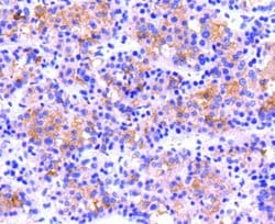 Integrin beta 3/CD61 Antibody (SJ19-09), Novus Biologicals 100&mu;L:Antibodies,