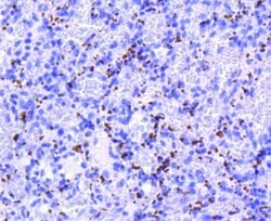 Integrin beta 3/CD61 Antibody (SJ19-09), Novus Biologicals 100&mu;L:Antibodies,