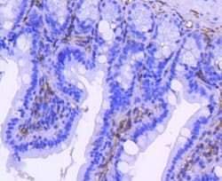 Integrin beta 3/CD61 Antibody (SJ19-09), Novus Biologicals 100&mu;L:Antibodies,