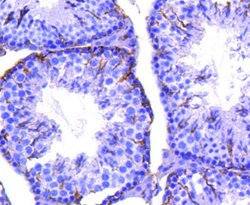 Integrin beta 3/CD61 Antibody (SJ19-09), Novus Biologicals 100&mu;L:Antibodies,