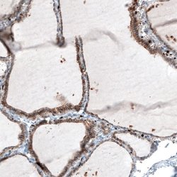 Integrin beta 3/CD61 Antibody (CL7319), Novus Biologicals 25 &mu;L; Integrin