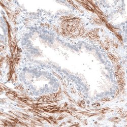 Integrin beta 3/CD61 Antibody (CL7319), Novus Biologicals 25 &mu;L; Integrin