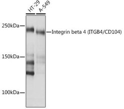 Integrin beta 4/CD104 Rabbit anti-Human, Mouse, Clone: 5Z9P3, Novus Biologicals 20 &mu;g | Buy Online | Bio-Techne | Fisher Scientific