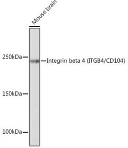 Integrin beta 4/CD104 Rabbit anti-Human, Mouse, Clone: 5Z9P3, Novus Biologicals 20 &mu;g | Buy Online | Bio-Techne | Fisher Scientific