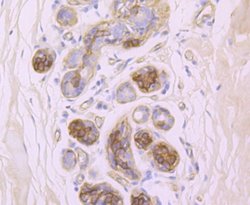 Integrinbeta4/CD104 Rabbit anti-Human, Clone: JM11-06, Novus Biologicals