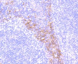 Integrinbeta4/CD104 Rabbit anti-Human, Clone: JM11-06, Novus Biologicals