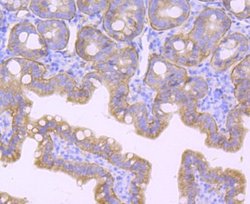 Integrinbeta4/CD104 Rabbit anti-Human, Clone: JM11-06, Novus Biologicals