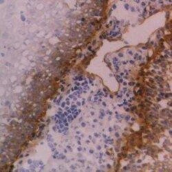 Integrin beta 4/CD104 Antibody (450-9D) - BSA Free, Novus Biologicals:Antibodies:Primary