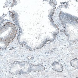 Integrin beta 4/CD104 Antibody (CL6972), Novus Biologicals 25 &mu;L; Integrin