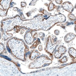 Integrin beta 4/CD104 Antibody (CL6972), Novus Biologicals 25 &mu;L; Integrin