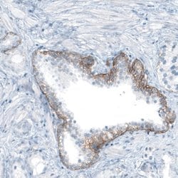 Integrin beta 4/CD104 Antibody (CL6973), Novus Biologicals 100 &mu;L | Buy Online | Novus Biologicals | Fisher Scientific