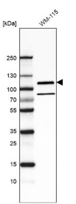 Integrin beta 8 Antibody (CL7290), Novus Biologicals 25 &mu;L; Unconjugated:Antibodies,