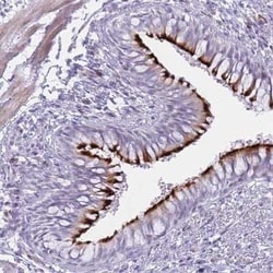 IFN-alpha K Antibody, Novus Biologicals 25 &mu;L, Unconjugated:Antibodies,