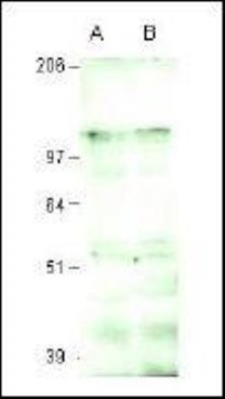 Intron-Binding Protein Of 160 KDa Antibody, Novus Biologicals 0.025 mg;