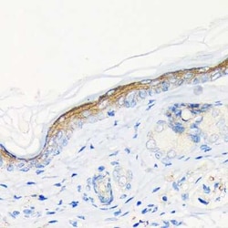 Involucrin Rabbit anti-Human, Mouse, Rat, Clone: 8H7B3, Novus Biologicals