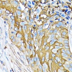 Involucrin Rabbit anti-Human, Mouse, Rat, Clone: 8H7B3, Novus Biologicals
