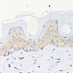 Involucrin Rabbit anti-Human, Mouse, Rat, Clone: 8H7B3, Novus Biologicals