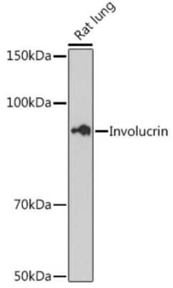 Involucrin Rabbit anti-Human, Mouse, Rat, Clone: 8H7B3, Novus Biologicals