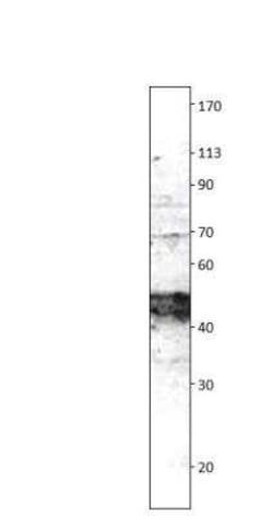 Irisin/FNDC5 Antibody, Novus Biologicals 100 &mu;g | Buy Online | Bio-Techne | Fisher Scientific