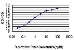 Iroquois-class homeodomain protein IRX-5 Antibody (3C11), Novus Biologicals 0.1 mg | Buy Online | Novus Biologicals | Fisher Scientific