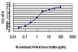 Iroquois-class homeodomain protein IRX-5 Antibody (6A9), Novus Biologicals