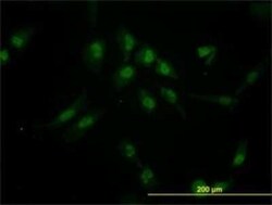 Iroquois-class homeodomain protein IRX-5 Antibody (6B5), Novus Biologicals 0.1 mg | Buy Online | Novus Biologicals | Fisher Scientific