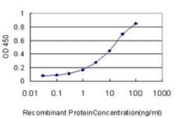 Iroquois-class homeodomain protein IRX-5 Antibody (8A12), Novus Biologicals